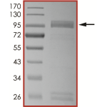 EGFR (T790M L792F L858R), Active